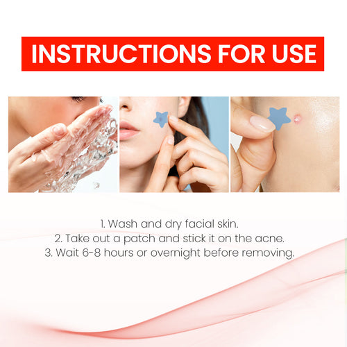 Acne Patch Dots-Invisible Pimple Treatment (200 Patches)