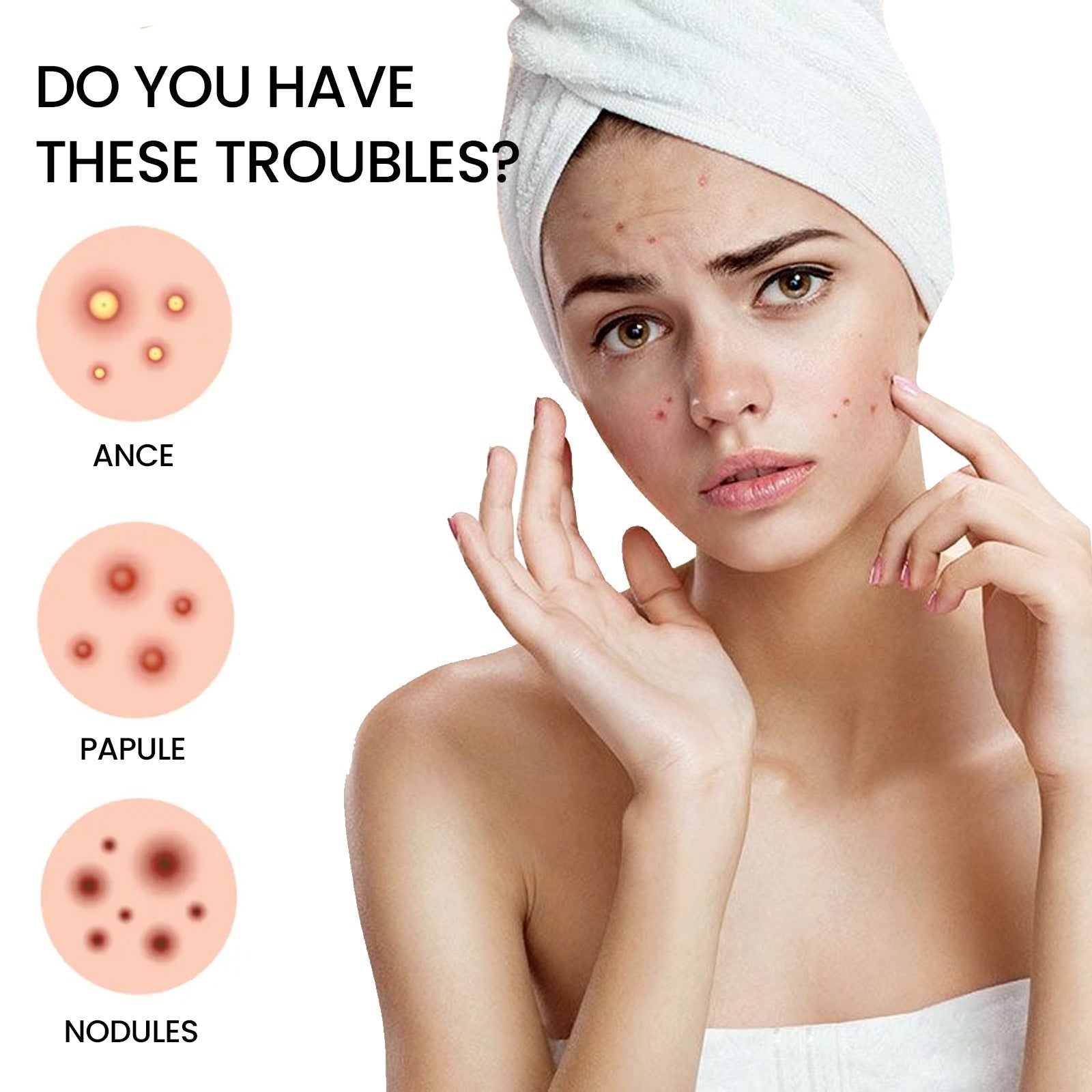 Acne Patch Dots-Invisible Pimple Treatment (200 Patches)